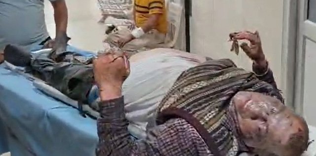 सेक्टर-24 फरीदाबाद स्थित केमिकल फैक्ट्री में भीषण आग के बाद ब्लास्ट, हादसे में तीन पुलिस और दो दमकल कर्मियों सहित लगभग 37 लोग झुलसे,करीब 15 वाहन जलकर खाक